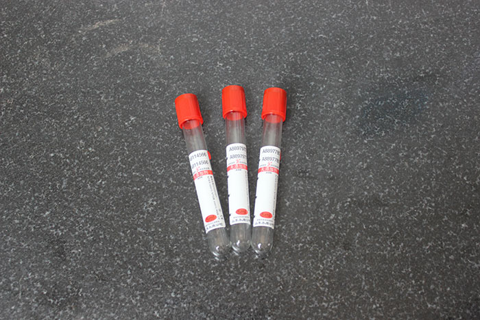 一次性使用病毒管厂家分享病毒管的使用位置