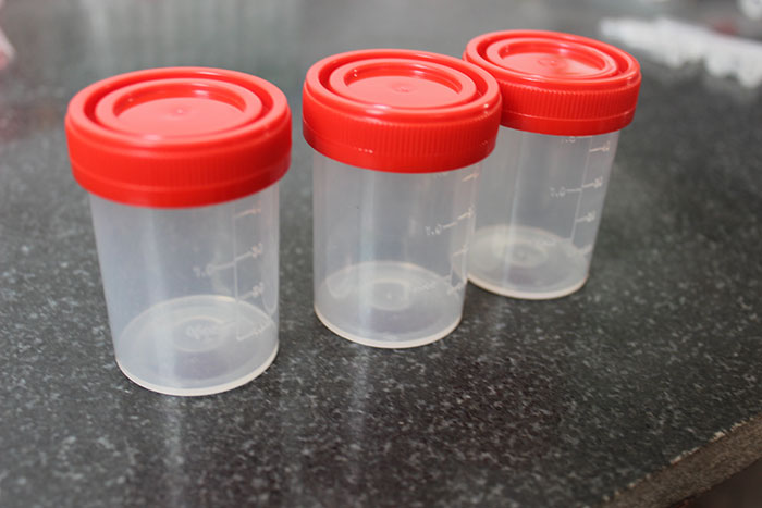 一次性痰杯厂家