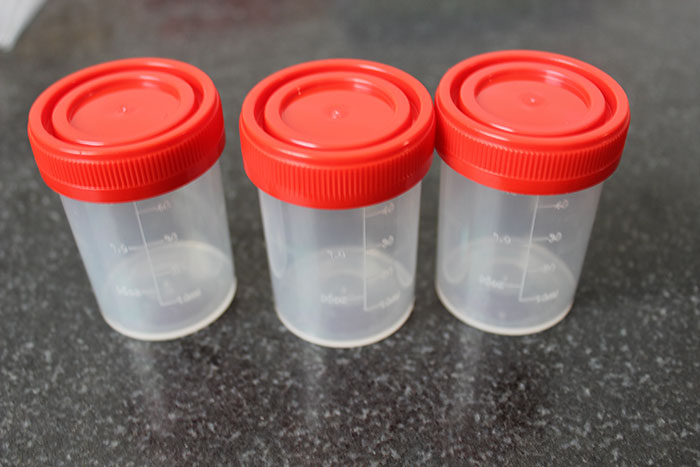 一次性医用痰杯